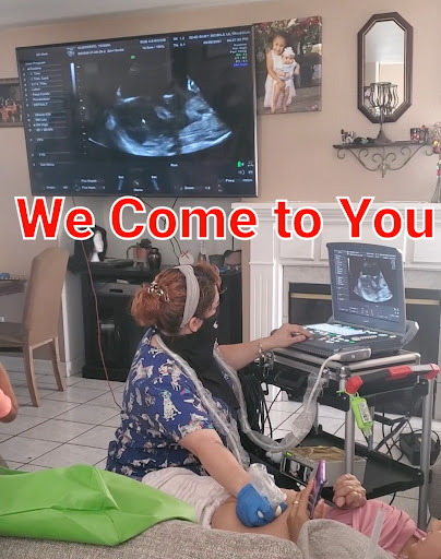 3D 4D Baby Mobile Ultrasound