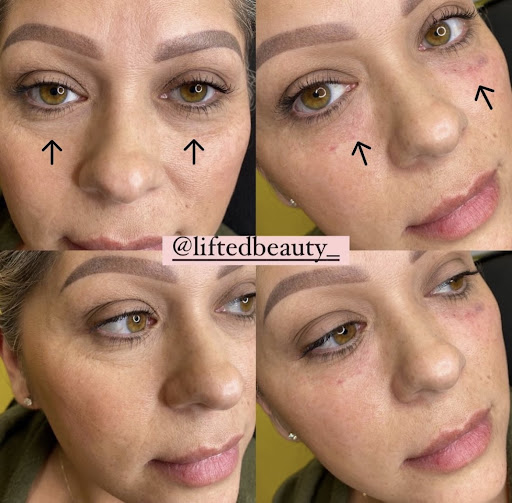 Lifted Beauty Medical Practice image