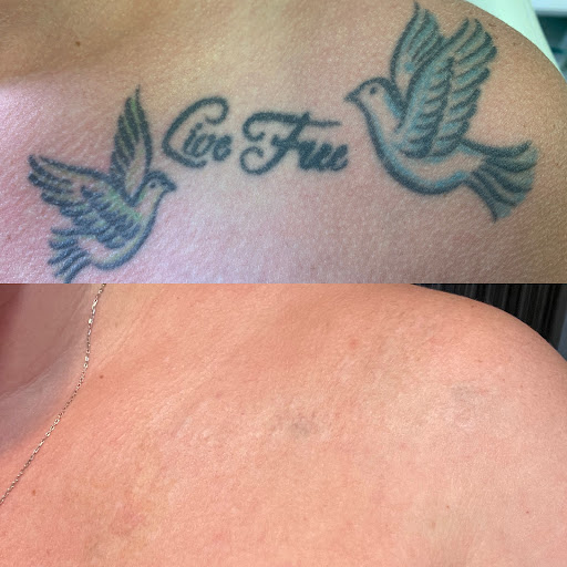 Explore simple line tattoo ideas, creative tattoo ideas in Denver, available at Wise Choice Tattoo Removal