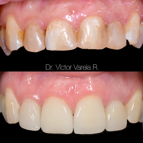 Odontología Central - Dr. Víctor Varela - Curanilahue