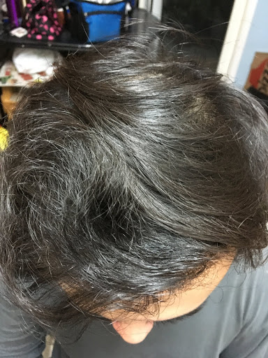 Hair Replacement Service «Medical Hair Transplants & Aesthetics», reviews and photos, 15055 Los Gatos Blvd Suite #110, Los Gatos, CA 95032, USA