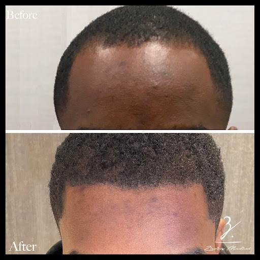 Ziering Medical Hair Restoration Beverly Hills image