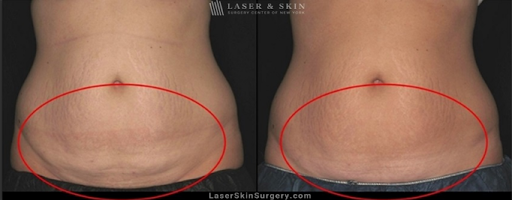 Explore tattoo ideas usa, creative tattoo ideas in Southampton, available at Laser & Skin Surgery Center of New York - Southampton