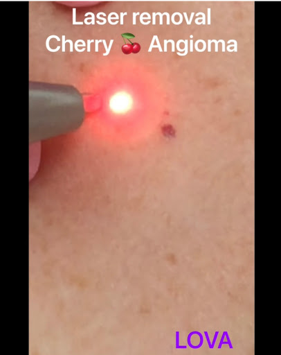 Explore tattoo ideas shoulder blade, creative tattoo ideas in Lake Oswego, available at Lake Oswego Vein and Aesthetic LOVA