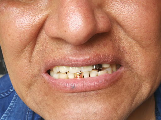 Comentarii opinii despre Qorident Laboratorio Dental