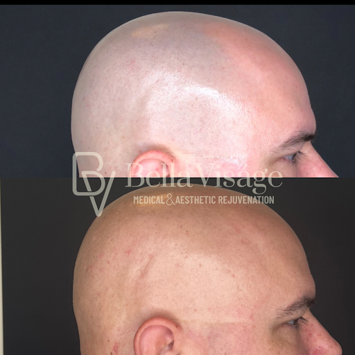 Explore ocean tattoo ideas for females, creative tattoo ideas in Lakeland, available at Bella Visge Medical & Aesthetic Rejuvenation