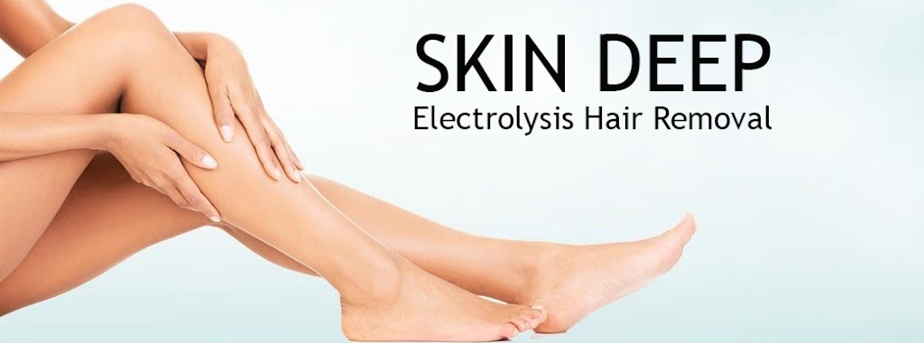 Skin Deep Electrolysis 35758