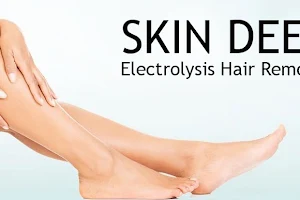 Skin Deep Electrolysis image
