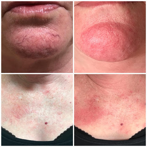 Explore mens wedding band tattoo ideas, creative tattoo ideas in Baton Rouge, available at Louisiana Laserderm