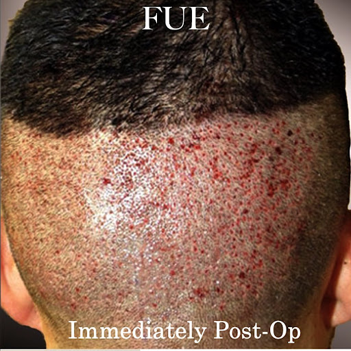 Ziering Medical Hair Restoration Beverly Hills image