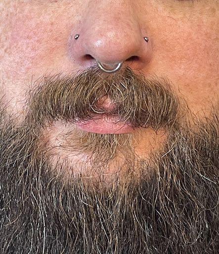 Explore endometriosis tattoo ideas, creative tattoo ideas in Meadville, available at Outstabbing Curations