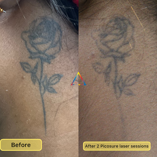 Explore women's leg tattoo ideas, creative tattoo ideas in New York, available at Ag2g Laser Tattoo Removal & MedSpa