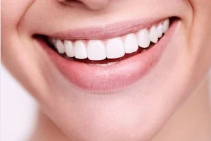 GlamSmile Wembley - Affordable Porcelain Veneers image