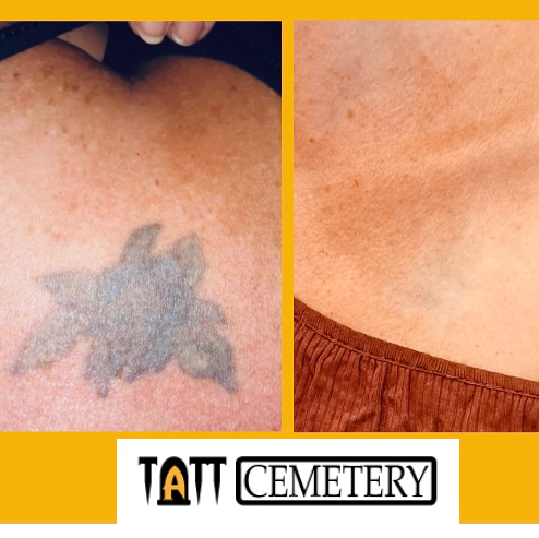 Explore tattoo ideas for women leg, creative tattoo ideas in Fort Myers, available at Laser Tattoo Removal by Tatt Cemetery