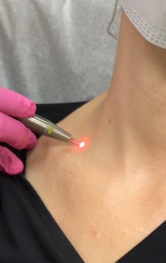 Explore nursing tattoo ideas, creative tattoo ideas in Lake Oswego, available at Lake Oswego Vein and Aesthetic LOVA