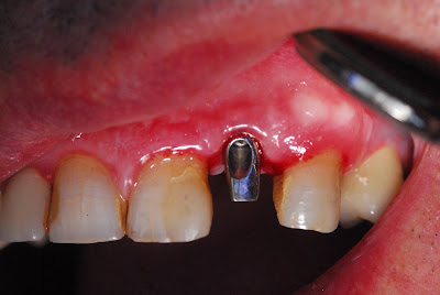 Dr Hue Laurent Chirurgien-Dentiste à Ploërmel