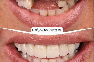 Clínica Dental Integral Dr. Bruno Negri image