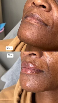 Endless Beauty Med Spa - Car repair in Tempe, AZ, Tempe - Rated 4.9/5