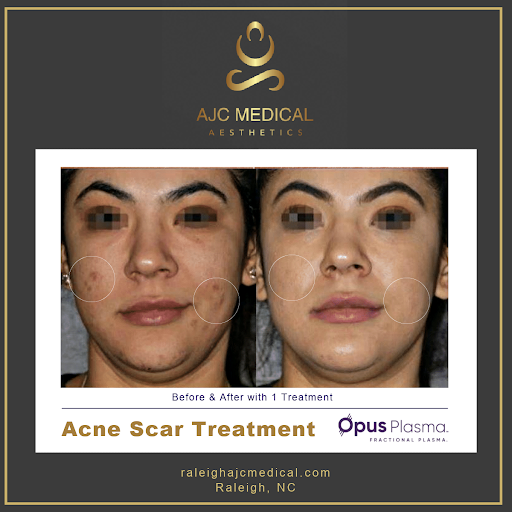 Explore simple medium tattoo ideas, creative tattoo ideas in Raleigh, available at AJC Medical Aesthetics