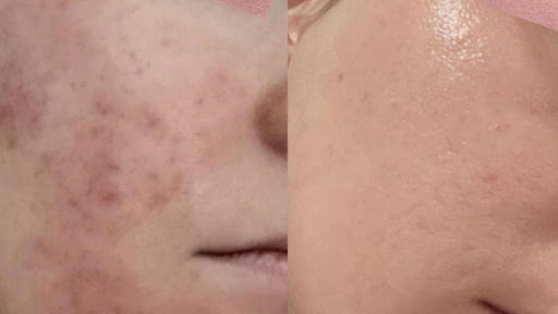 Beauty Oasis Rx Facial Clinic, 977 Raintree Cir #220, Allen, TX 75013, USA, 