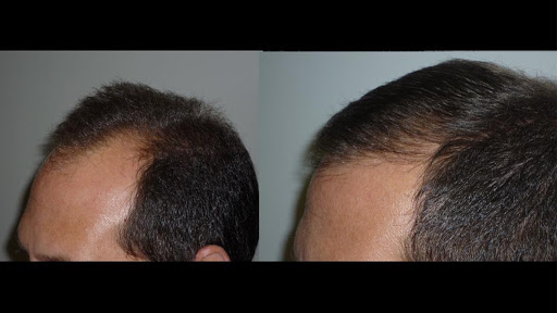 Hair & Facial Plastics Institute-Dr. James Aronovitz
