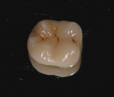 The Cherrytree Dental Clinic - The Cherrytree Dental Clinic