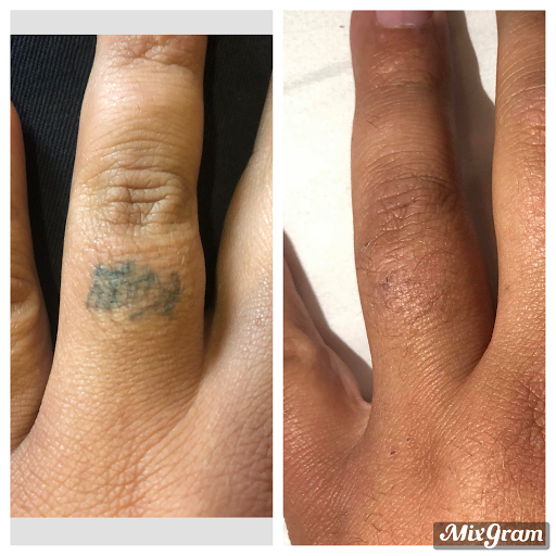 Explore small warrior tattoo ideas, creative tattoo ideas in Longview, available at Vanish Laser Aesthetics