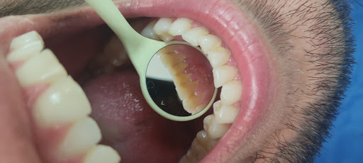 Dentistas ortodoncistas en Guayaquil