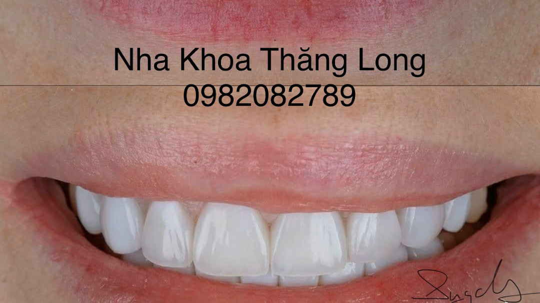 Nha Khoa Thăng Long