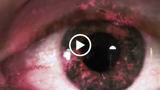 Ophthalmology Clinic «Ft. Lauderdale Eye Associates», reviews and photos, 2466 E Commercial Blvd, Fort Lauderdale, FL 33308, USA