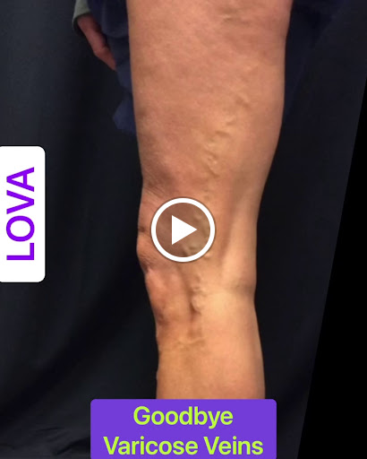 Find tattoo ideas for new moms for your next unique tattoo in Lake Oswego at Lake Oswego Vein and Aesthetic LOVA