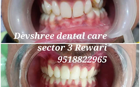 Devshree Dental Care- Best Dental Implant Hospital | Smile Designing with Zirconia Crowns | Affordable Painless RCT in Rewari image