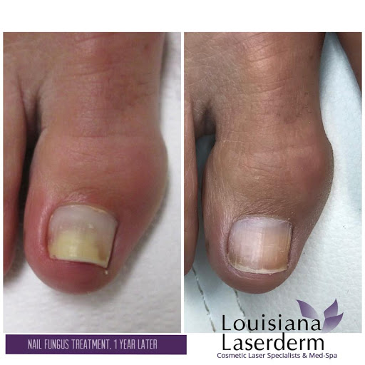 Explore i am the storm tattoo ideas, creative tattoo ideas in Baton Rouge, available at Louisiana Laserderm