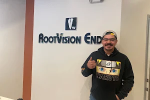 RootVision Endo image