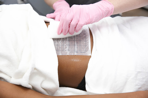 Explore stevie nicks tattoo ideas, creative tattoo ideas in Tampa, available at LaserAway