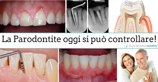 Studio Dentistico Cozzolino - Implantologia e Parodontologia