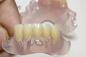 Oral Dental image