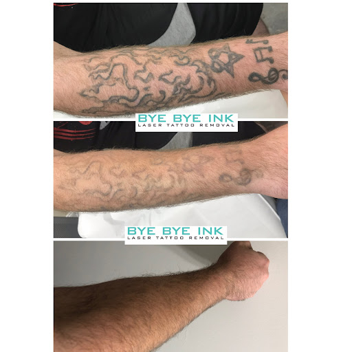 Explore men tattoo design ideas, creative tattoo ideas in Middle Village, available at Bye Bye Ink Laser Tattoo Removal