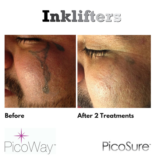 Explore fine line finger tattoo ideas, creative tattoo ideas in Pleasant Grove, available at Inklifters Tattoo Removal