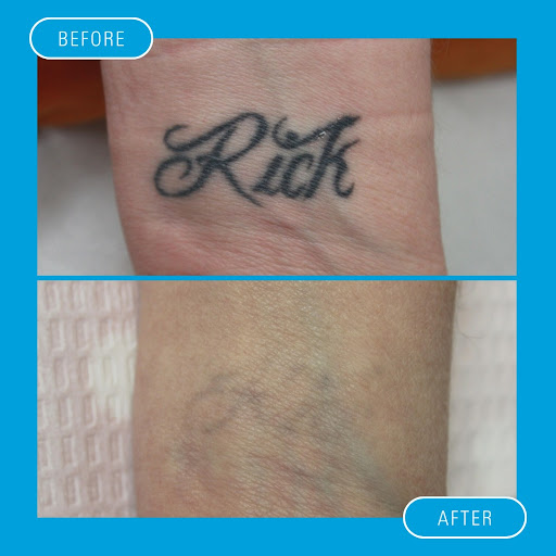 Explore portland oregon tattoo ideas, creative tattoo ideas in Chandler, available at Removery Tattoo Removal & Fading