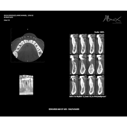 Almax Radiología - Laboratorio