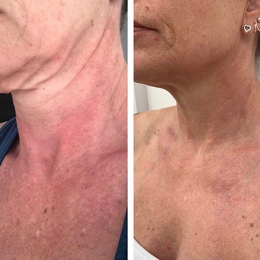 Explore drum tattoo ideas, creative tattoo ideas in Tucson, available at Allure Medical