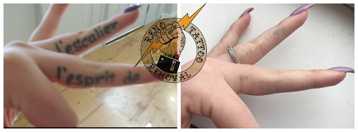 Explore small nyc tattoo ideas, creative tattoo ideas in Reno, available at Reno Tattoo Removal