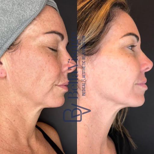 Explore rock climbing tattoo ideas, creative tattoo ideas in Lakeland, available at Bella Visge Medical & Aesthetic Rejuvenation