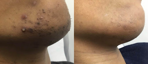 Explore star tattoo ideas for guys, creative tattoo ideas in Des Moines, available at Bare Beaute Permanent Hair Removal By Electrolysis, LLC