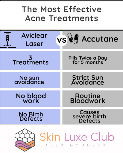 Explore matching tattoo ideas for guys, creative tattoo ideas in Bayside, available at Laser Goddess