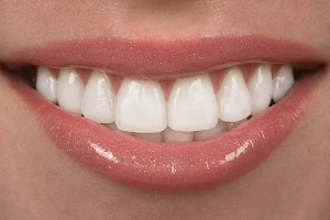 Dental Symmetry image