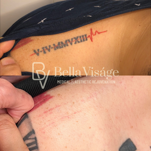 Explore upper chest tattoo ideas, creative tattoo ideas in Lakeland, available at Bella Visge Medical & Aesthetic Rejuvenation