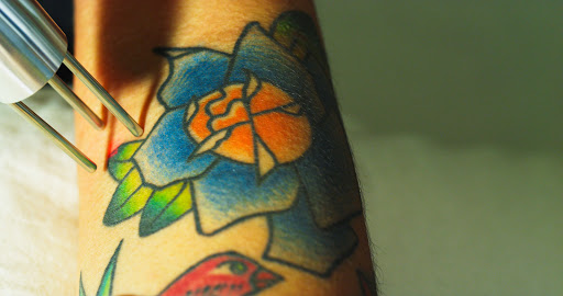 Explore time heals tattoo ideas, creative tattoo ideas in Verona, available at Madison Laser Tattoo Removal