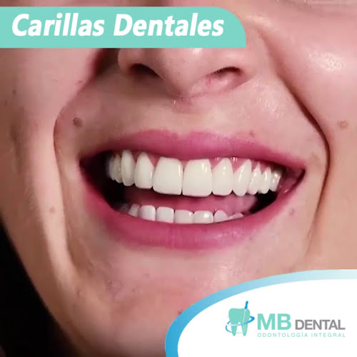 MB DENTAL - Dentista